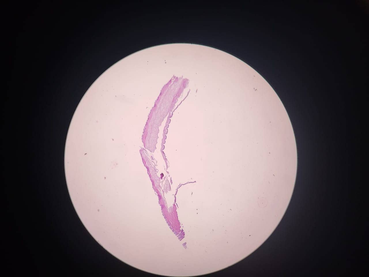 Fragments of Dirofilaria Hematoxylin and Eosin staining at 10X magnification